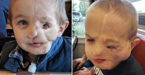 Boy, 5, survives savage attack by two dogs only to be called a ‘monster’ in public