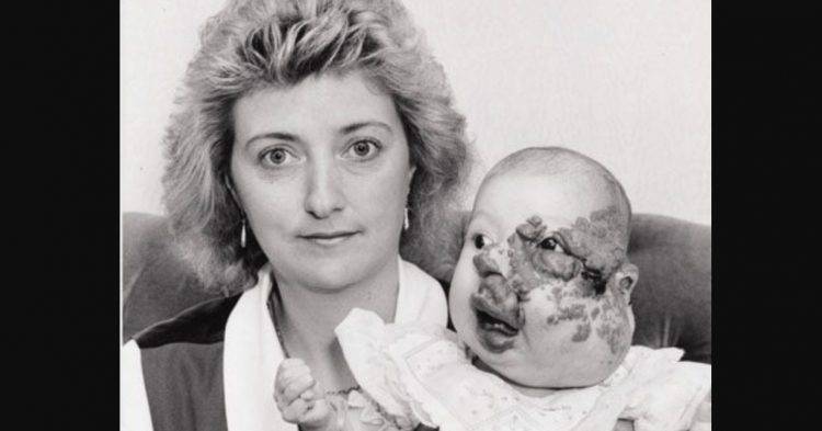 She Was Born With A Severe Birth Defect, But You’d Never Be Able To Recognize Her Now